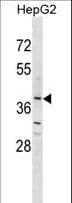 OR2K2 Antibody (aa2-29)