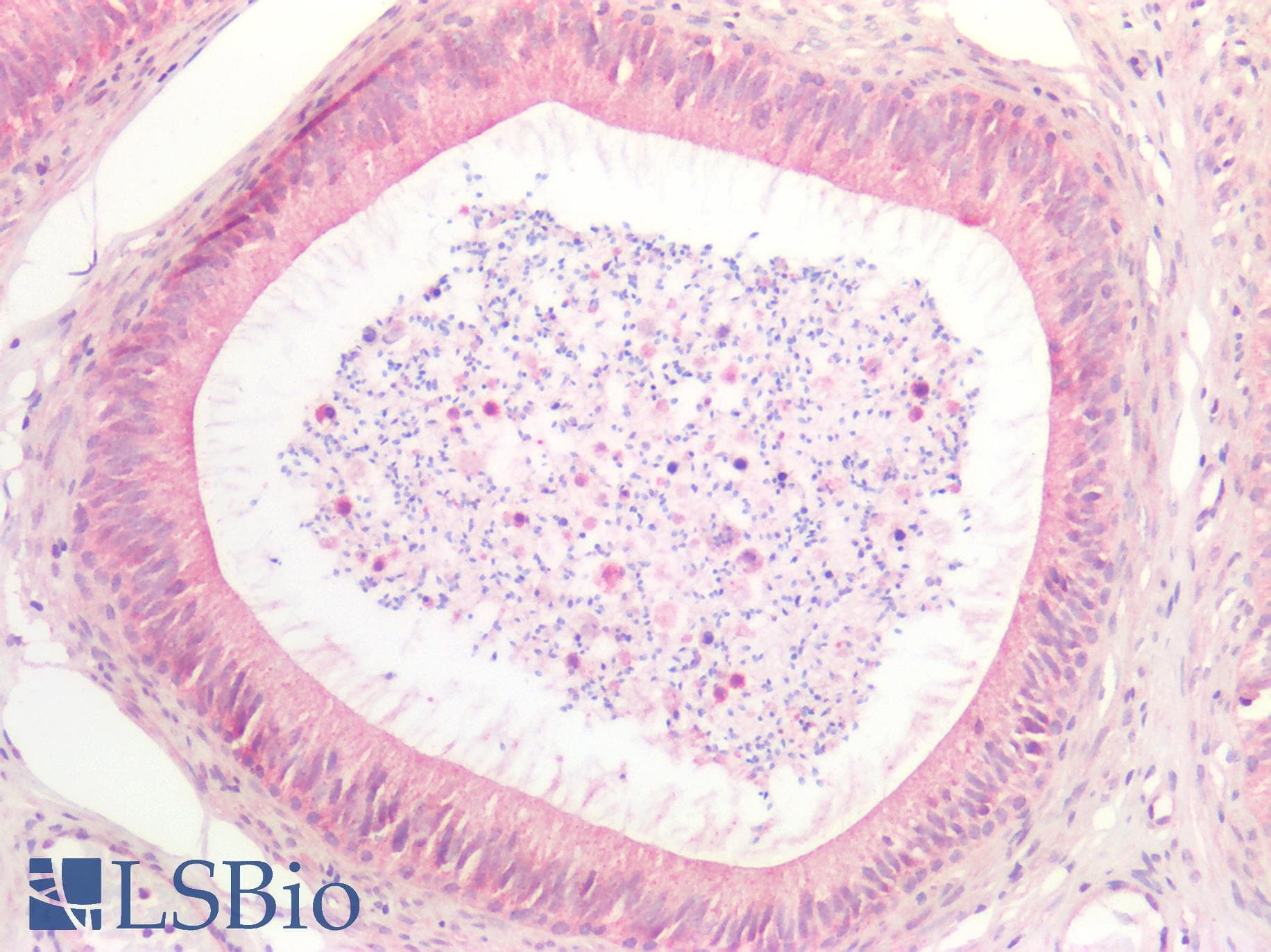 PathPlus™ RAMA1 / SKA3 Antibody