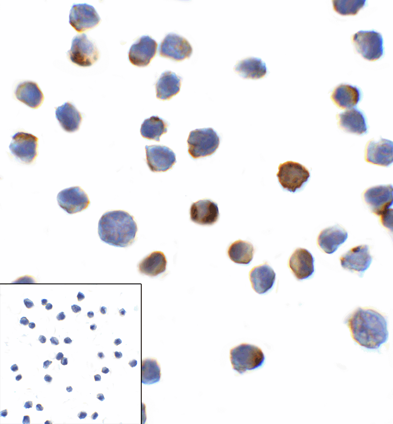 Monoclonal Mouse anti-Human LAG3 Antibody (clone 2G8, IHC, IF, WB)