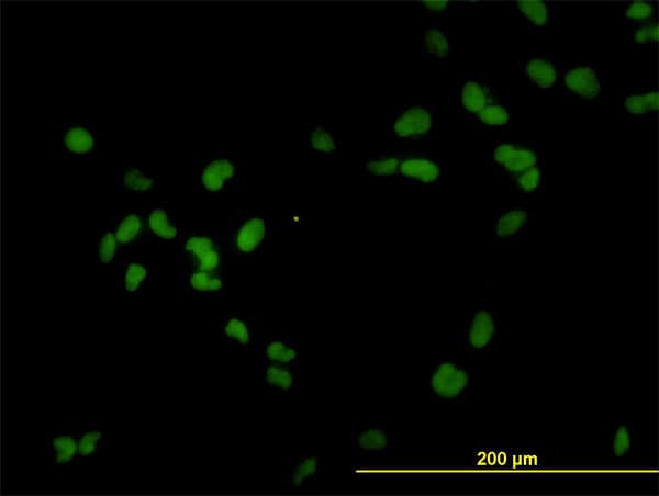 IHC-plus™ Monoclonal Mouse anti-Human RCC1 Antibody (clone 2F1, IHC, IF, WB)