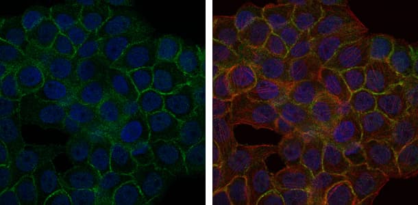 BLNK Antibody (clone 5G9)