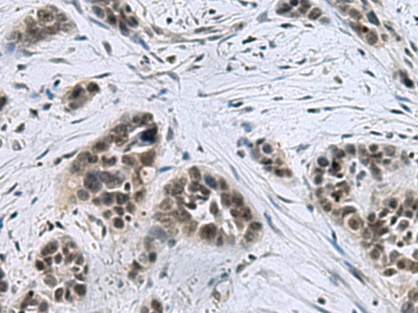 Polyclonal Rabbit anti-Human CCAR2 / KIAA1967 Antibody (IHC)