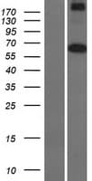 Human MARS2 Protein (Over-Expression Lysate Myc-DDK (Flag))