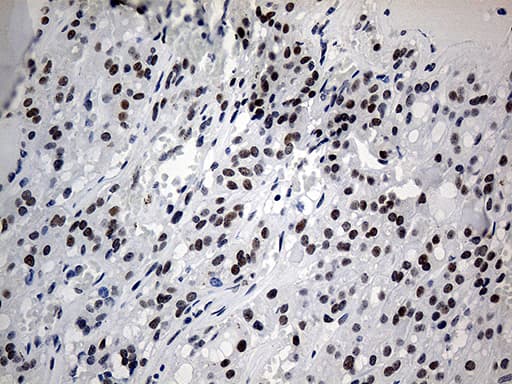 ZNF454 Antibody (clone OTI8B5)