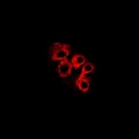 C4BPB / C4BP Beta Antibody
