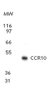 IHC-plus™ CCR10 / GPR2 Antibody (aa350-362)
