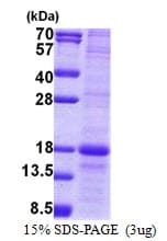 Human MD-1 / LY86 Protein (Recombinant His)