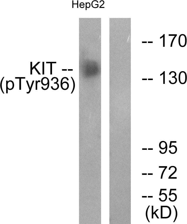 c-Kit / CD117 Antibody (phospho-Tyr936)