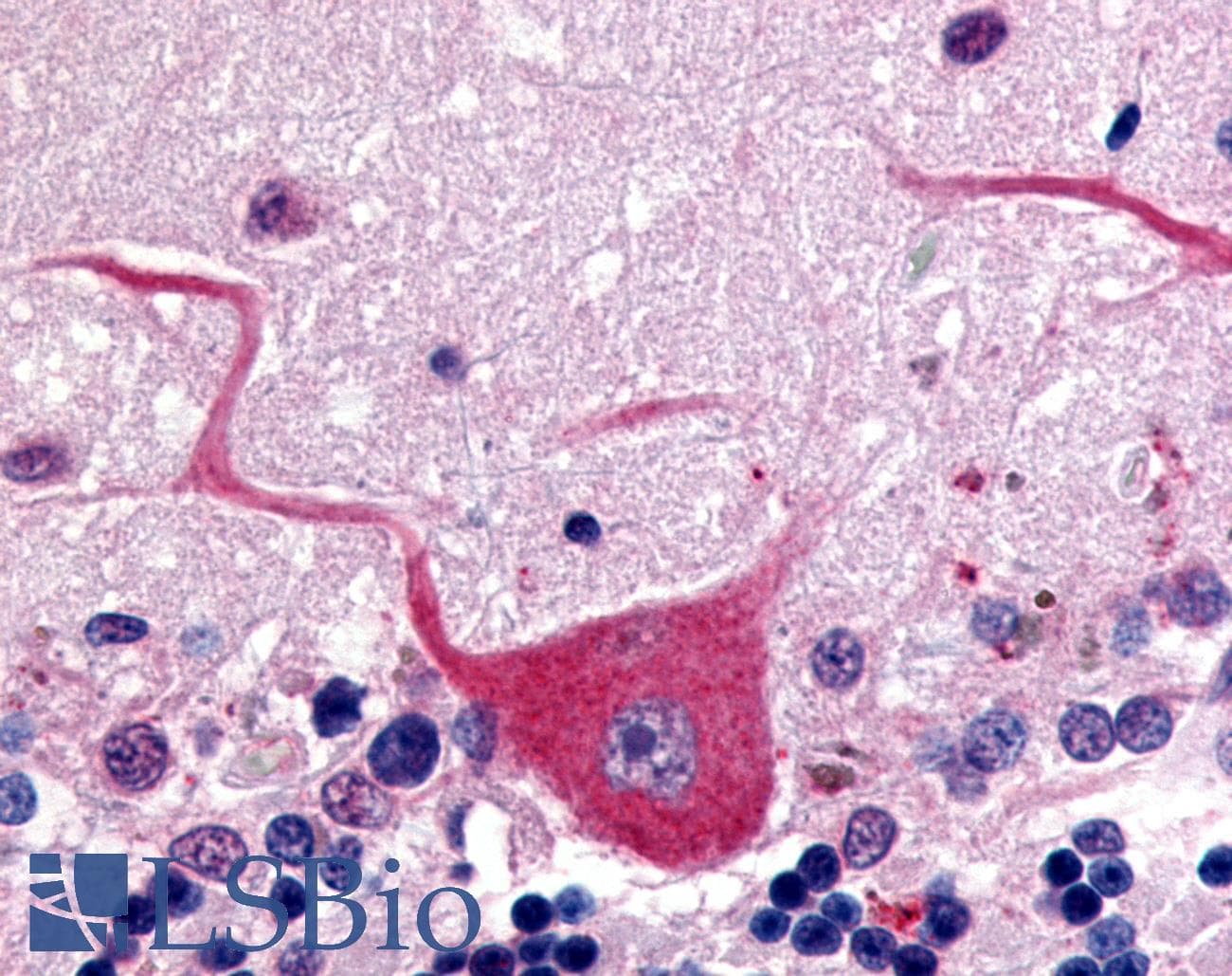 IHC-plus™ Polyclonal Rabbit anti-Human GPR32 Antibody (C-Terminus, IHC)