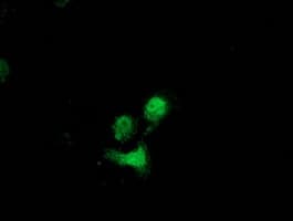 DSTN / Destrin Antibody (clone OTI2F7)