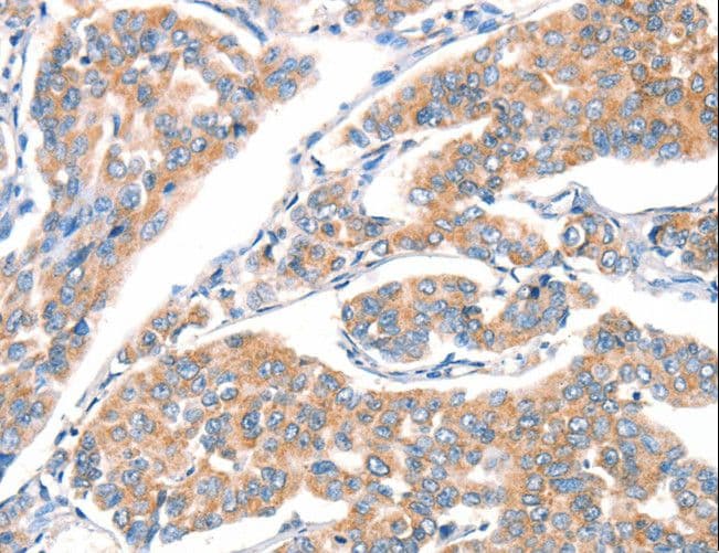 Polyclonal Rabbit anti-Human ART4 Antibody (IHC, WB)