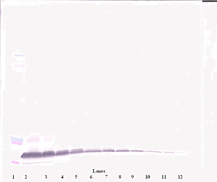 Polyclonal Rabbit anti-Human BTC / Betacellulin Antibody (Biotin, WB)