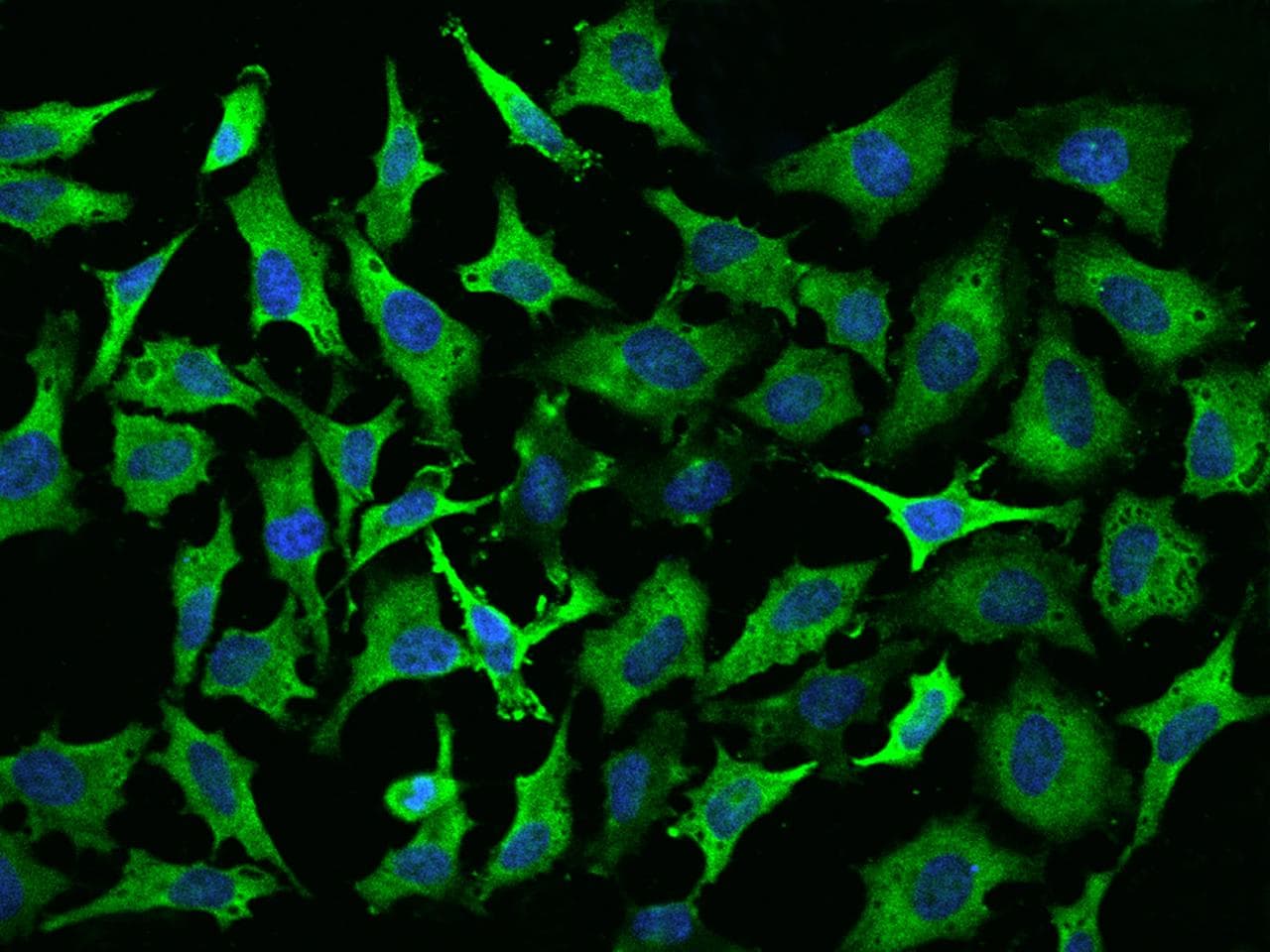 EEF1A2 Antibody