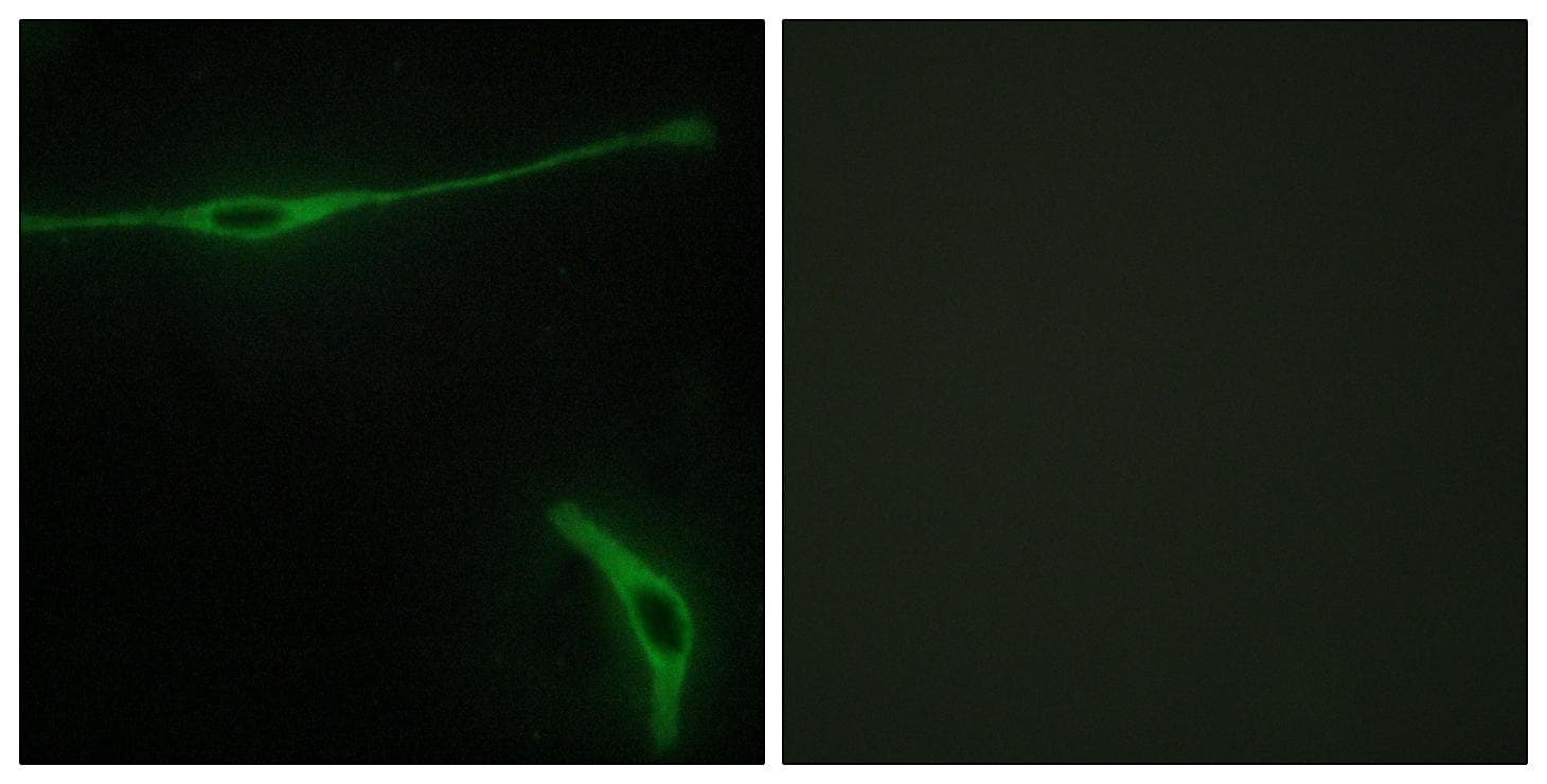 Polyclonal Rabbit anti-Human LAMA2 / Merosin Antibody (IHC, IF)