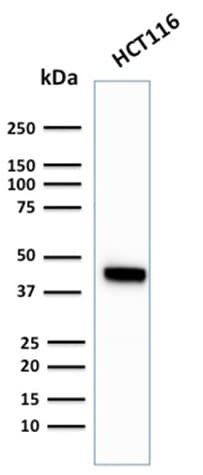 KRT18 / CK18 / Cytokeratin 18 Antibody (clone KRT18/2819R, Azide-free, Carrier-free)