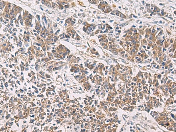 Polyclonal Rabbit anti-Human PAIP1 Antibody (IHC, WB)