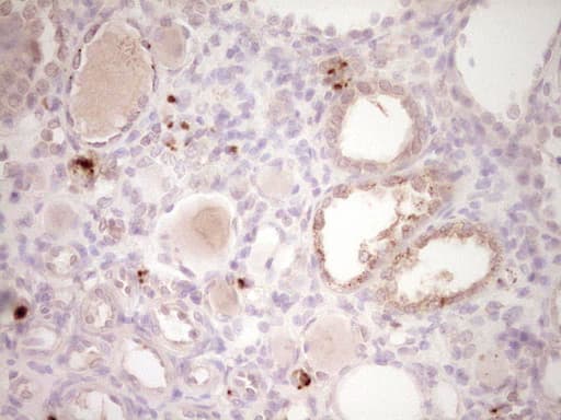PTGS2 / COX2 / COX-2 Antibody (aa18-260, clone OTI1B4)