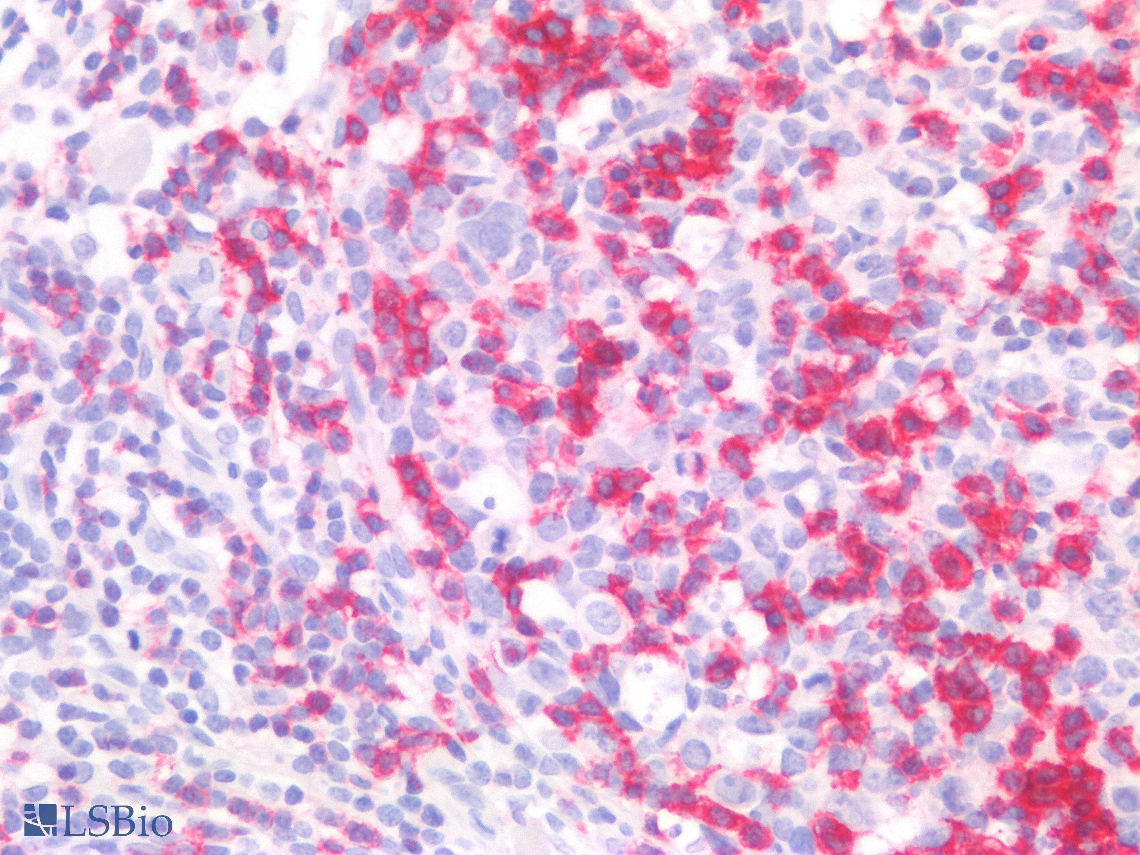 PathPlus™ PDCD1 / CD279 / PD-1 Antibody (clone AHC0211)