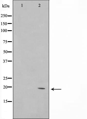 Polyclonal Rabbit anti-Human COX4I2 Antibody (IF, WB)