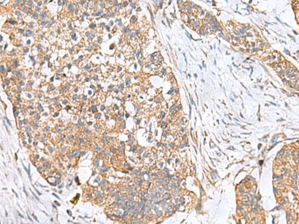 Polyclonal Rabbit anti-Human CEMIP / KIAA1199 Antibody (IHC)