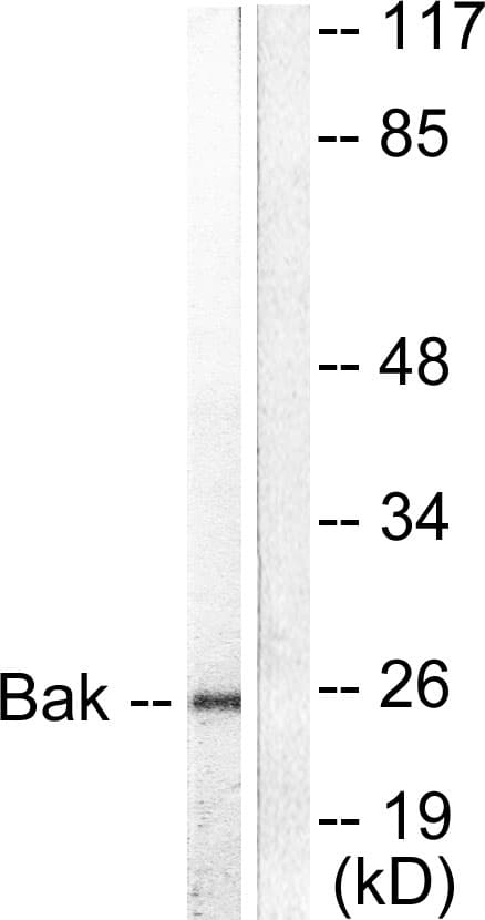 BAK1 / BAK Antibody (aa1-50)