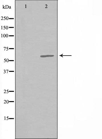 Polyclonal Rabbit anti-Human B4GALNT1 / GM2/GD2 Synthase Antibody (aa302-325, IF, WB)