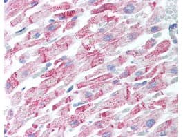 APP / Beta Amyloid Precursor Antibody