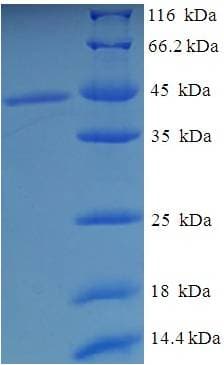 Human PLAT / TPA Protein (Recombinant His-SUMO)