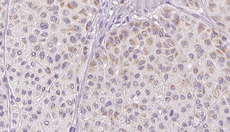 Polyclonal Rabbit anti-Human CCL2 / MCP1 Antibody (IHC, WB)
