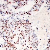 Polyclonal Rabbit anti-Human TOP2A / Topoisomerase II Alpha Antibody (Internal, IHC, WB)