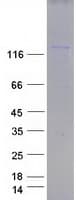 Human SMARCC1 / SWI3 Protein (Recombinant Myc-DDK (Flag))