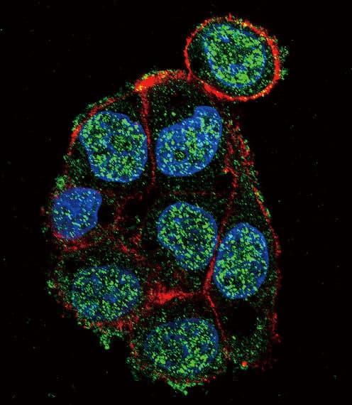 VHL / Von Hippel Lindau Antibody (aa43-71)