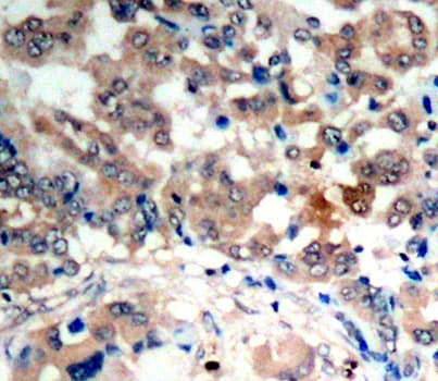 PRKAA1 / AMPK Alpha 1 Antibody (phospho-Thr174)