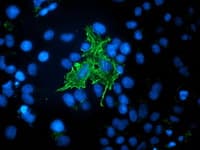 VASP Antibody (clone OTI1H8)