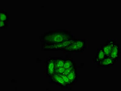 Polyclonal Rabbit anti-Human RARB / RAR Beta Antibody (IF)