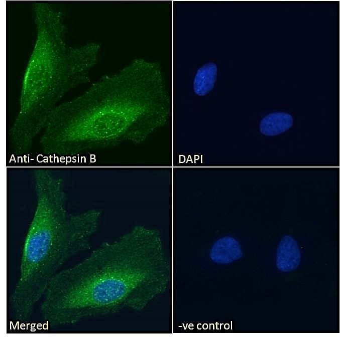 PathPlus™ Polyclonal Goat anti-Human CTSB / Cathepsin B Antibody (Internal Region, IHC, IF, WB)