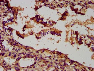 UNC5H2 / UNC5B Antibody
