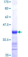Human SPATA2 Protein (Recombinant GST, N-terminus)