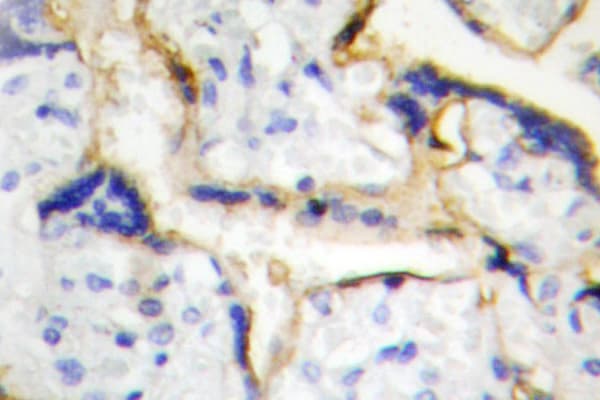 CSNK1E / CK1 Epsilon Antibody (Pro301)