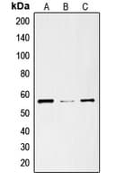 Polyclonal Rabbit anti-Human SLC29A1 / ENT1 Antibody (N-Terminus, WB)