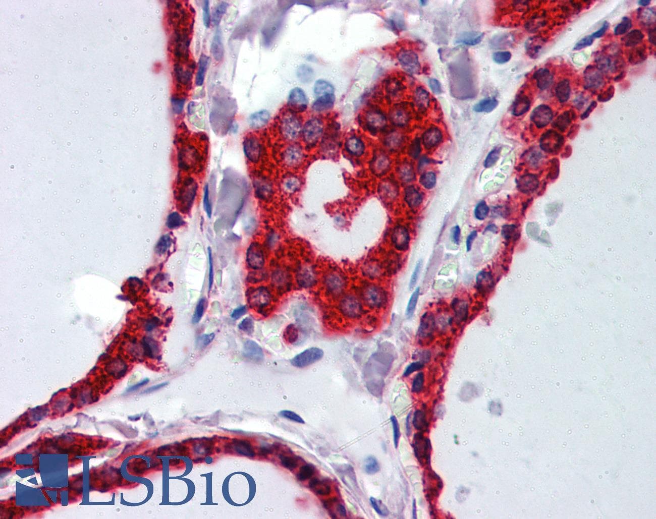 IHC-plus™ Monoclonal Mouse anti-Human WNT5A Antibody (clone 3D10, IHC, WB)