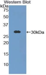 GIF / Intrinsic Factor Antibody (aa196-414, FITC)