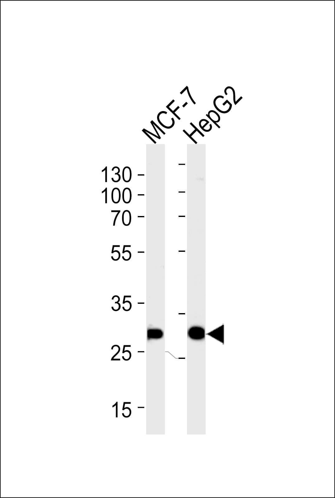 PSME2 Antibody (aa61-91)