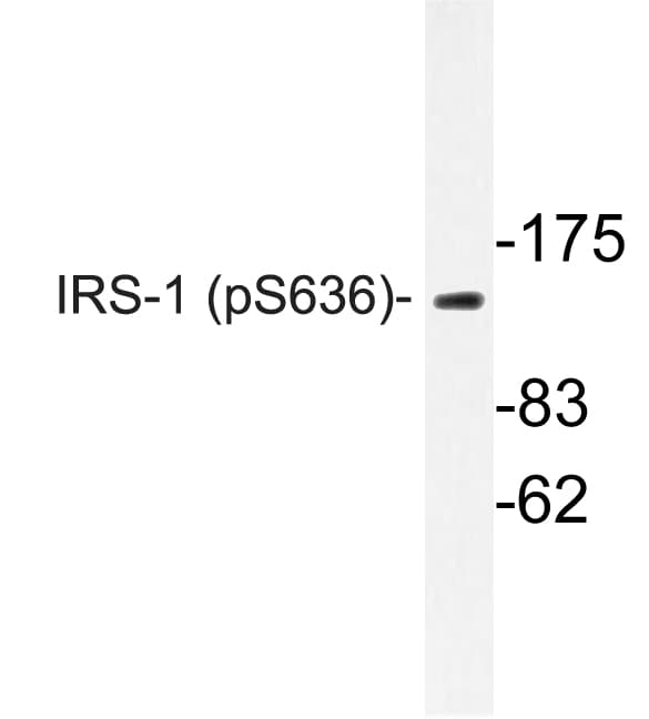 IRS1 Antibody (phospho-Ser636)