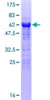 Human VGLL4 Protein (Recombinant GST)