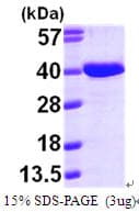 Human AASDHPPT / LYS5 Protein (Recombinant His)