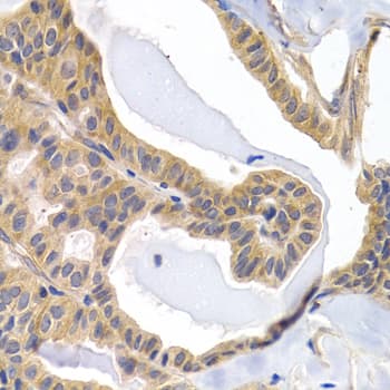 PTGIR / IP Receptor Antibody