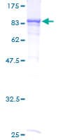 Human RIOK2 Protein (Recombinant GST)