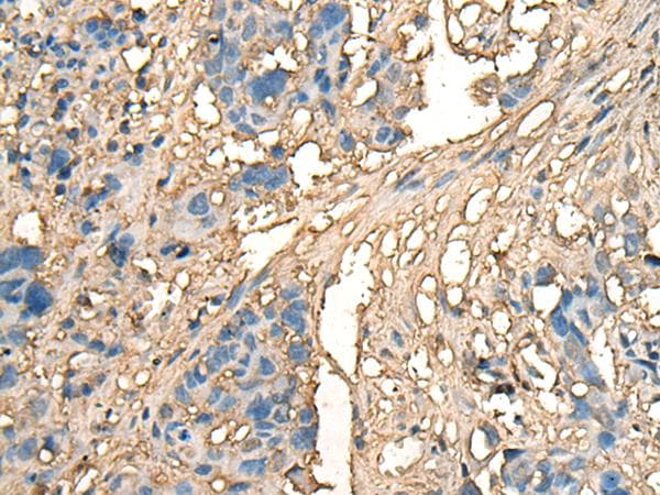 Polyclonal Rabbit anti-Human CELA1 / Pancreatic Elastase 1 Antibody (IHC)