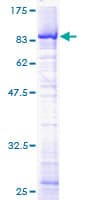 Human TOE1 Protein (Recombinant GST)